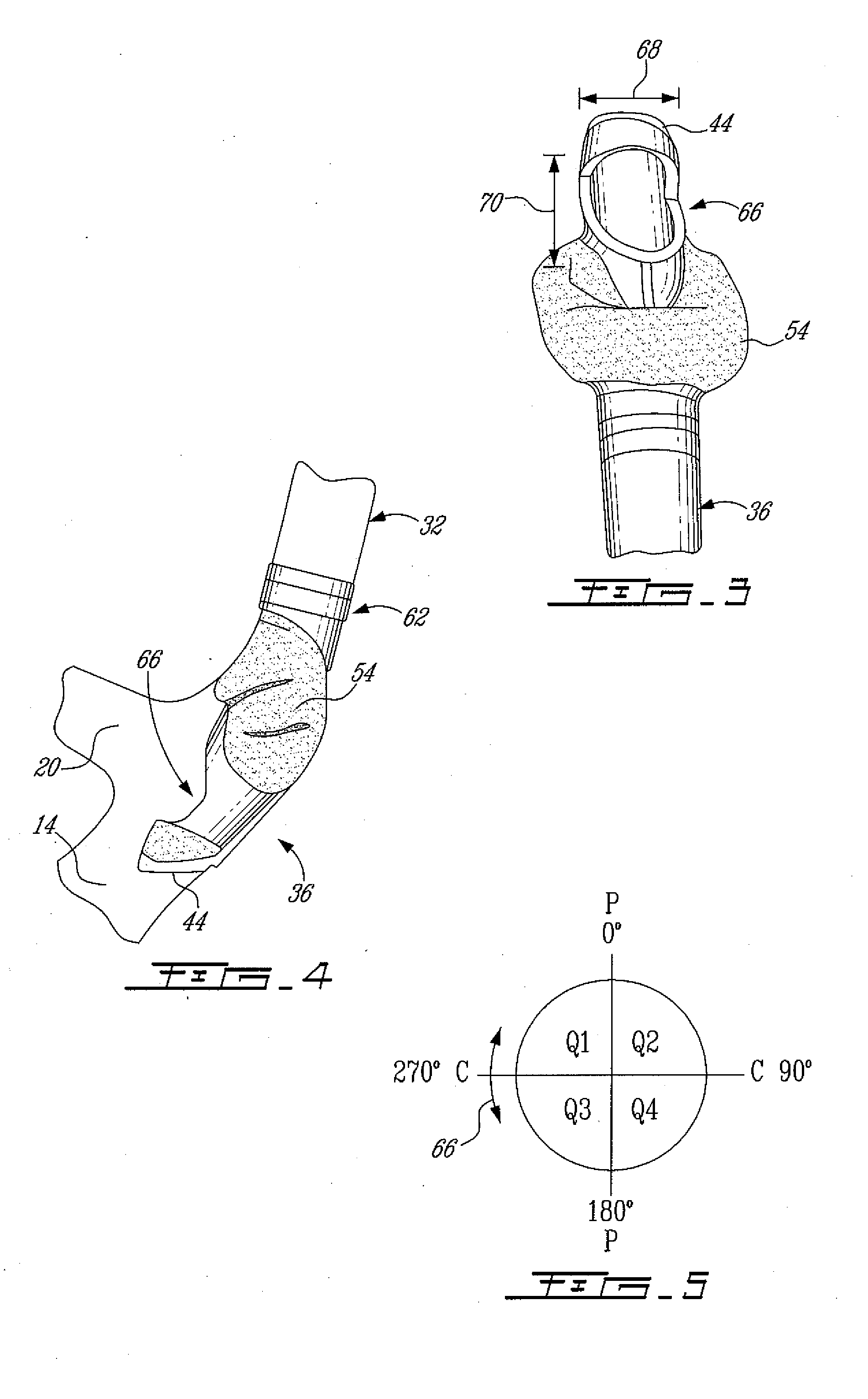 Right double lumen endobronchial tube