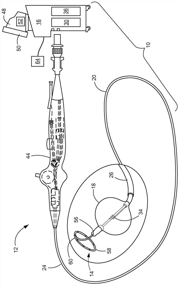 Medical system for delivering optimal cryogenic dose based on time to effect (tte)