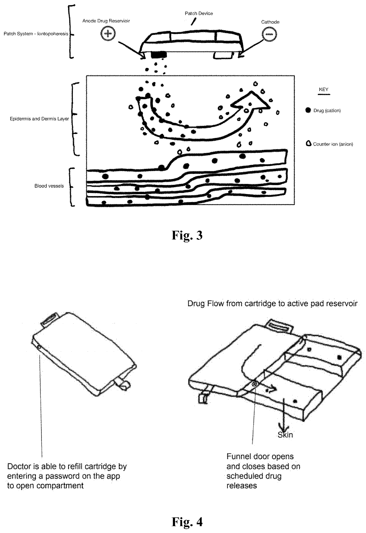 Transdermal drug delivery system