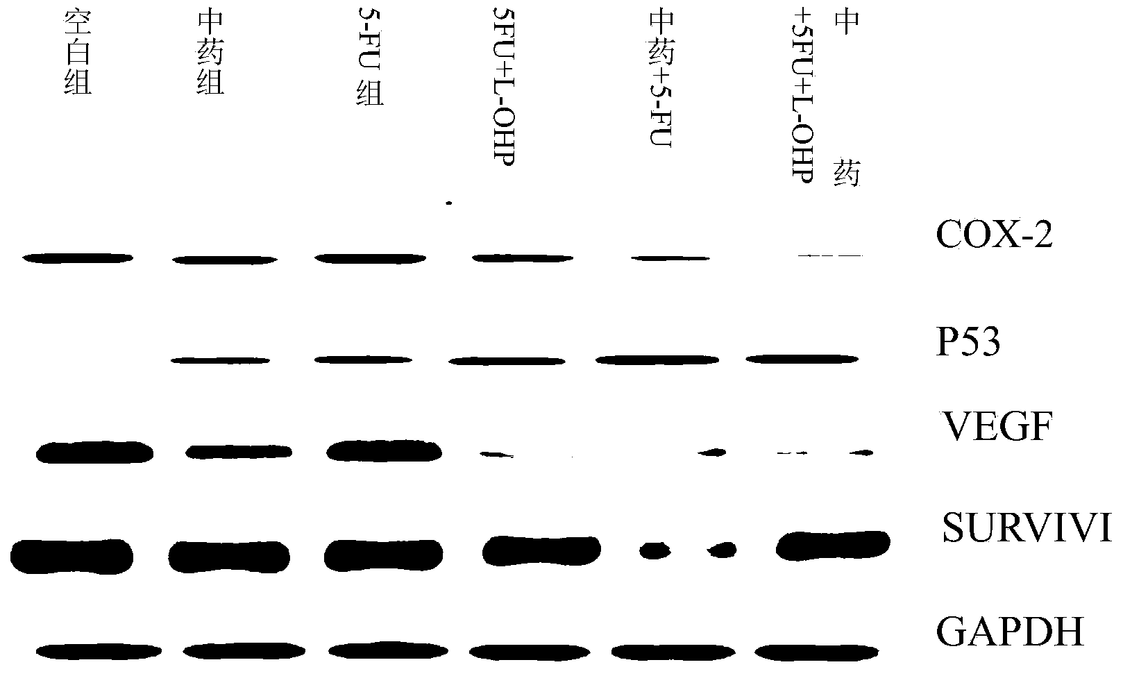 Traditional Chinese medicine compound preparation for reducing postoperative recurrence and metastasis of colorectal cancer and preparation method of traditional Chinese medicine compound preparation