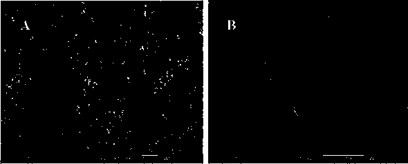 Method for preparing microspheres by using oil-in-nanoparticle mixed suspension-nanometer medicament-in-oil