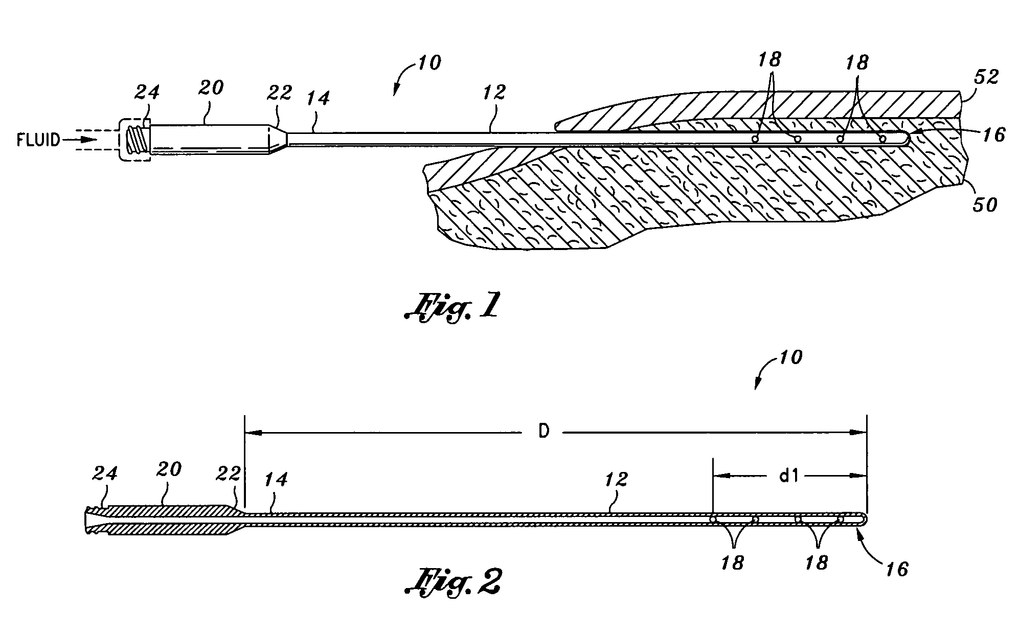 Infiltration cannula