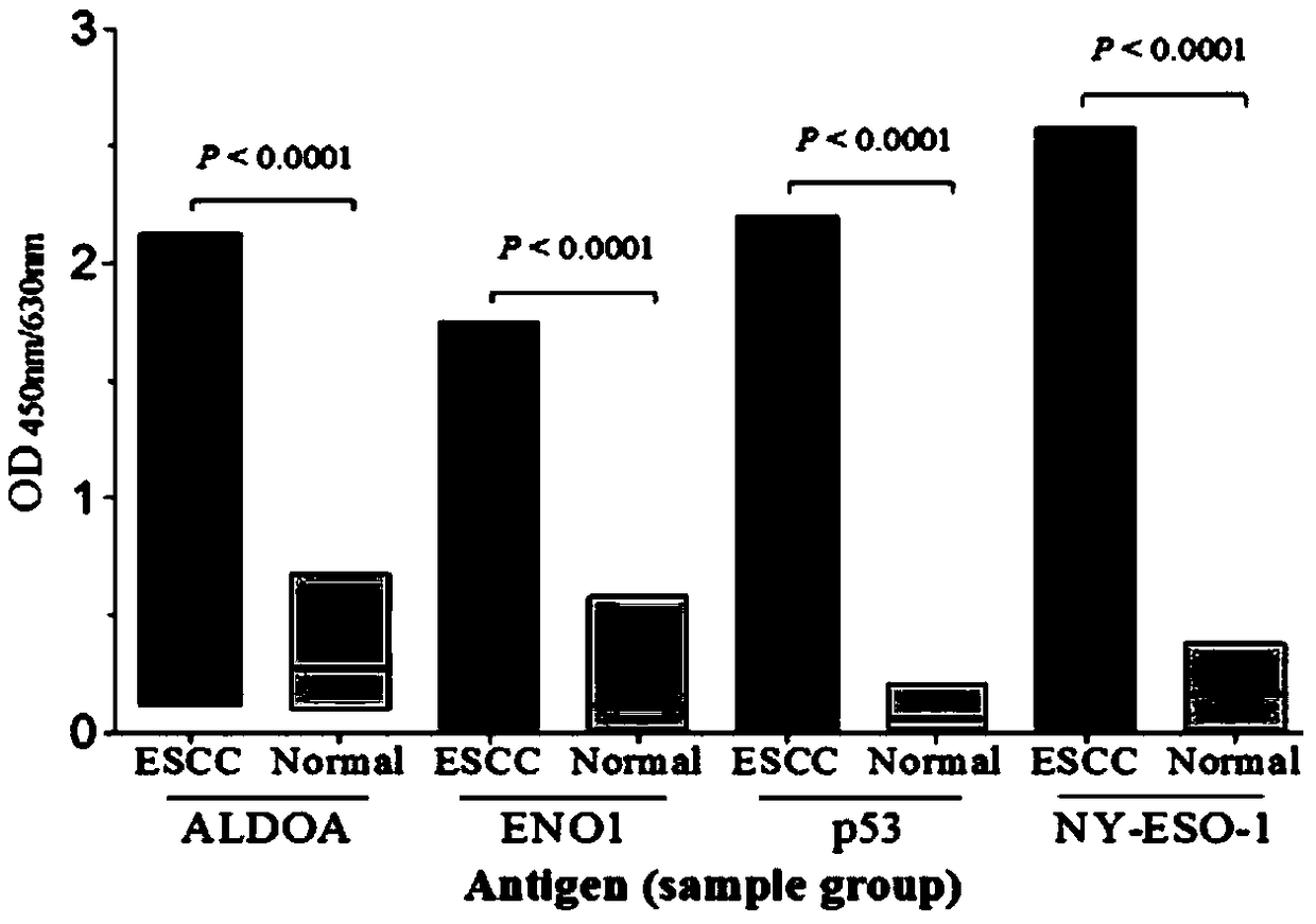 Esophageal squamous cell carcinoma autoantibody molecular marker model and application thereof