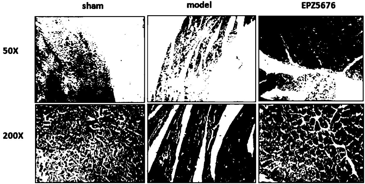 Application of compound EPZ5676 and related inhibitor thereof in preparing drug for preventing and treating myocardial fibrosis diseases