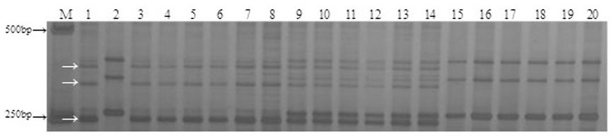 Transintron Molecular Marker of Wheat Powdery Mildew Resistance Gene mlxbd and Its Application