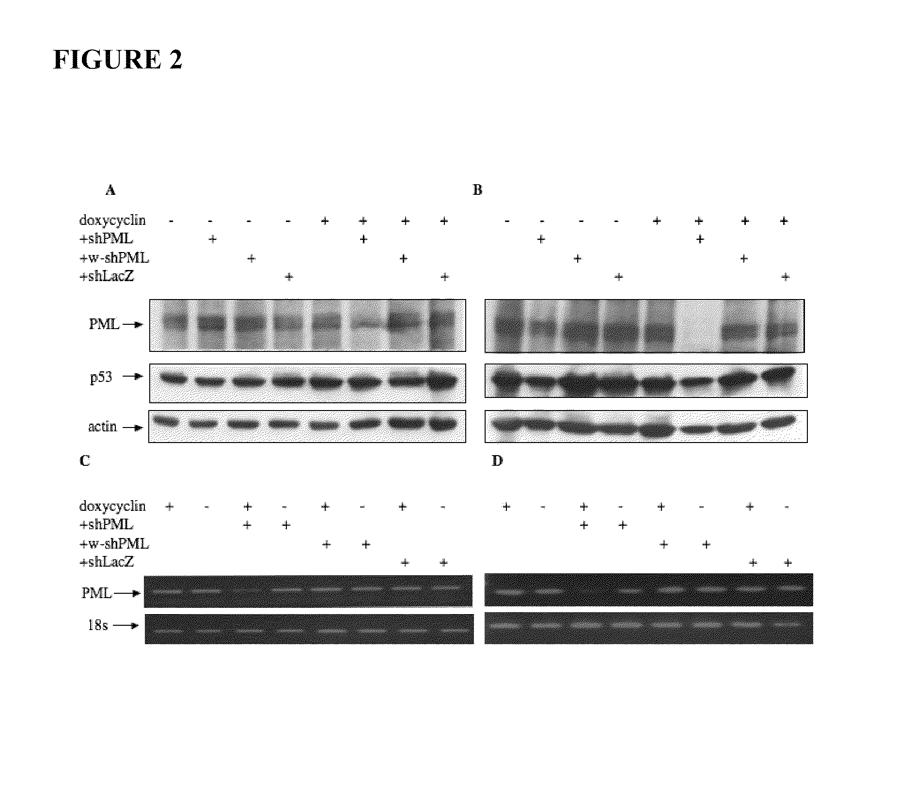 Therapy of p53 mutant colon adenocarcinoma, breast cancer and lung cancer