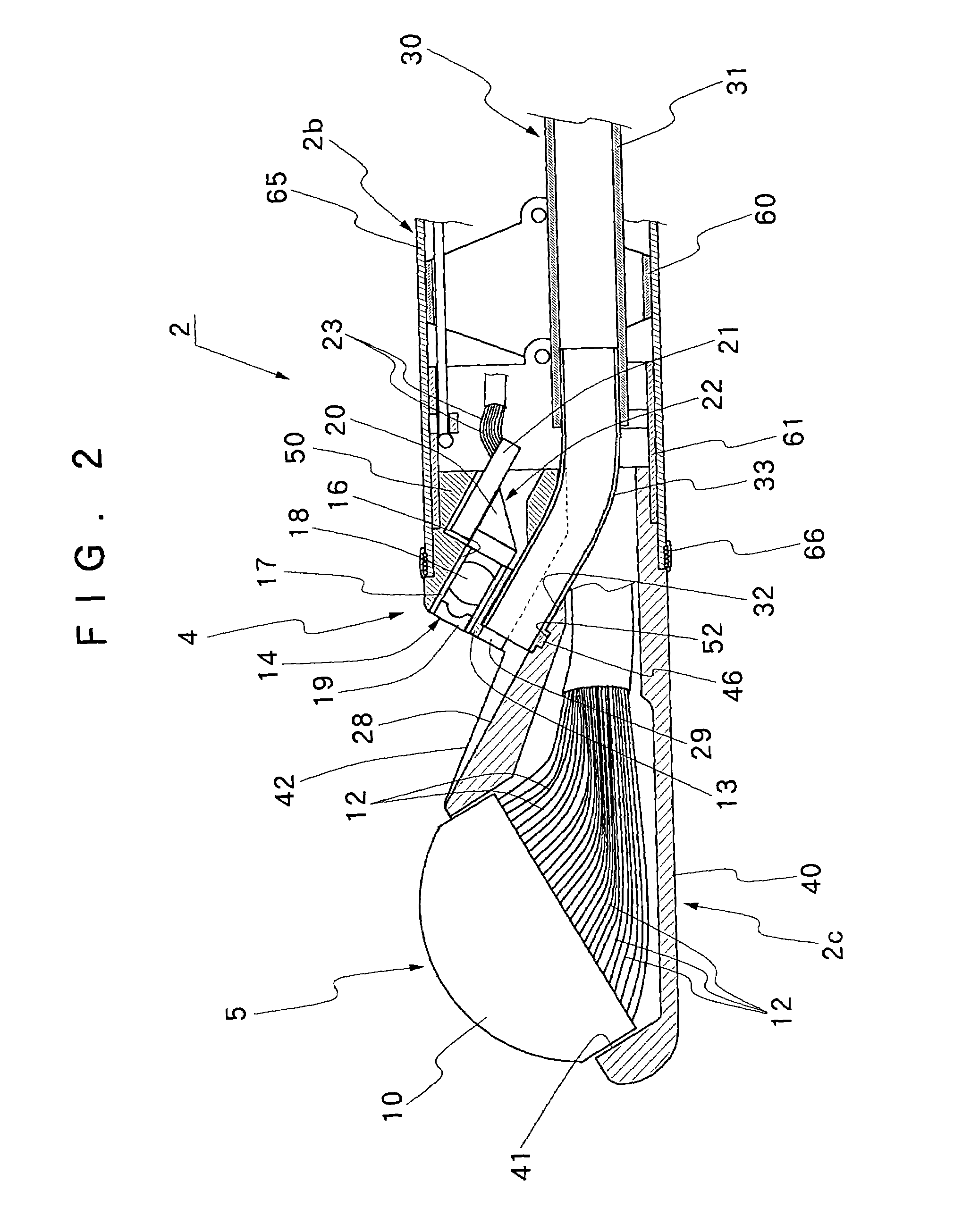 Ultrasound endoscope