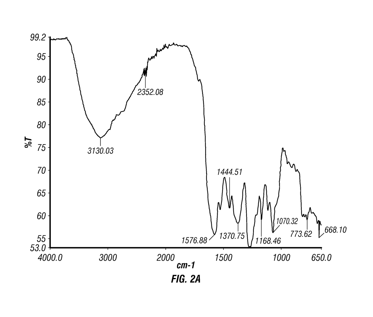 Epinephrine nanoparticles, methods of fabrication thereof, and methods for use thereof for treatment of conditions responsive to epinephrine