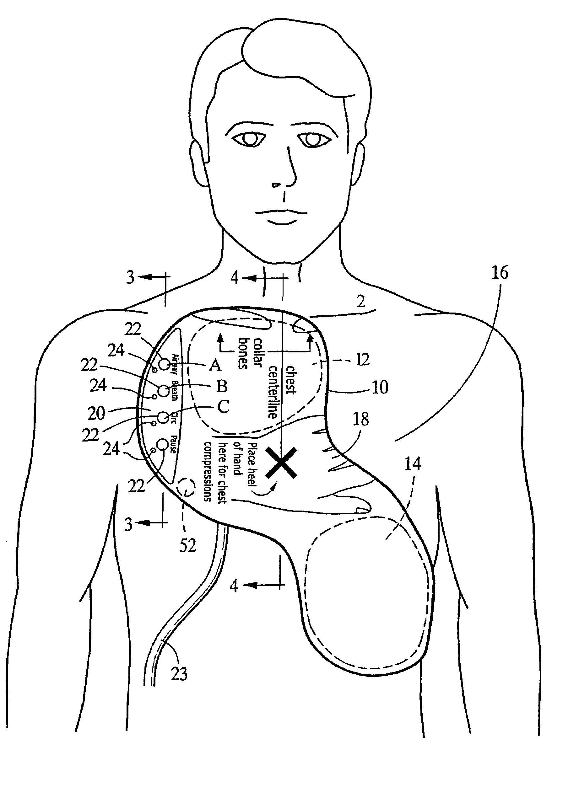 Integrated resuscitation