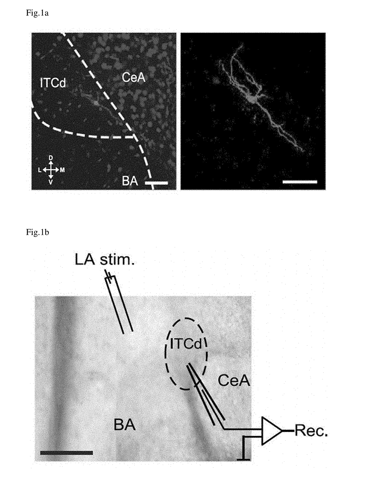 Pharmaceutical composition for treating posttraumatic stress disorder