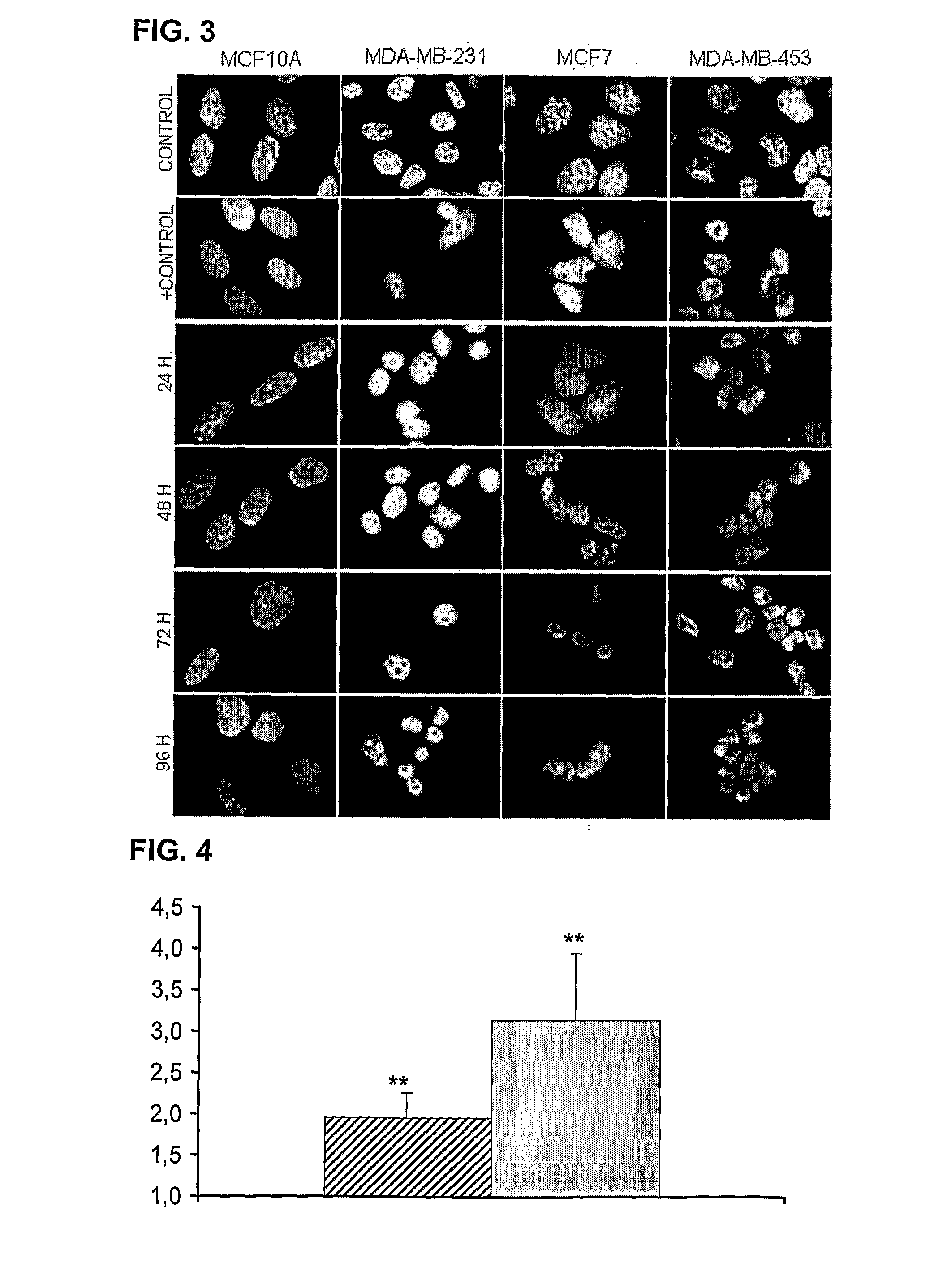 Antibodies for treating cancer