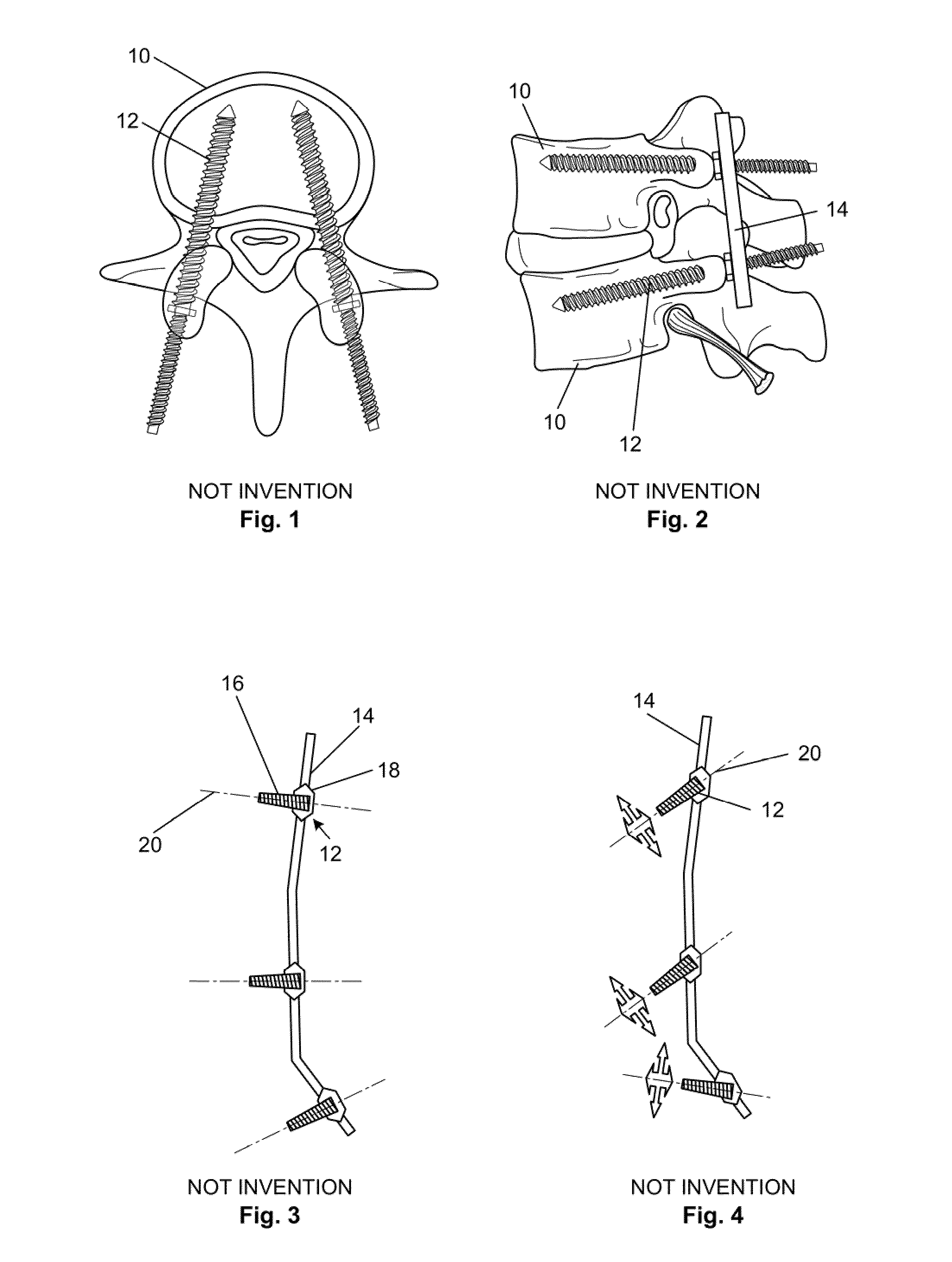 Expandable attachment device and method