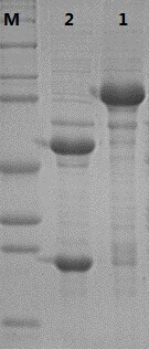 Type 52 recombinant human papillomavirus virus-like particle and its preparation method