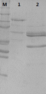 Type 52 recombinant human papillomavirus virus-like particle and its preparation method