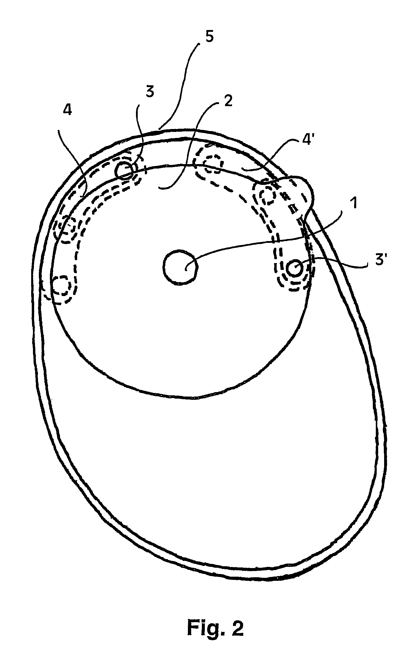 Ostomy appliance with multiple openings for preventing filter input blockage