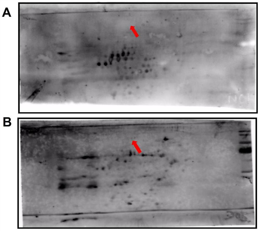 Application of reagent for detecting anti-cytoskeleton associated protein 4-IgG autoantibody in preparation of kit for detecting vascular endothelial injury