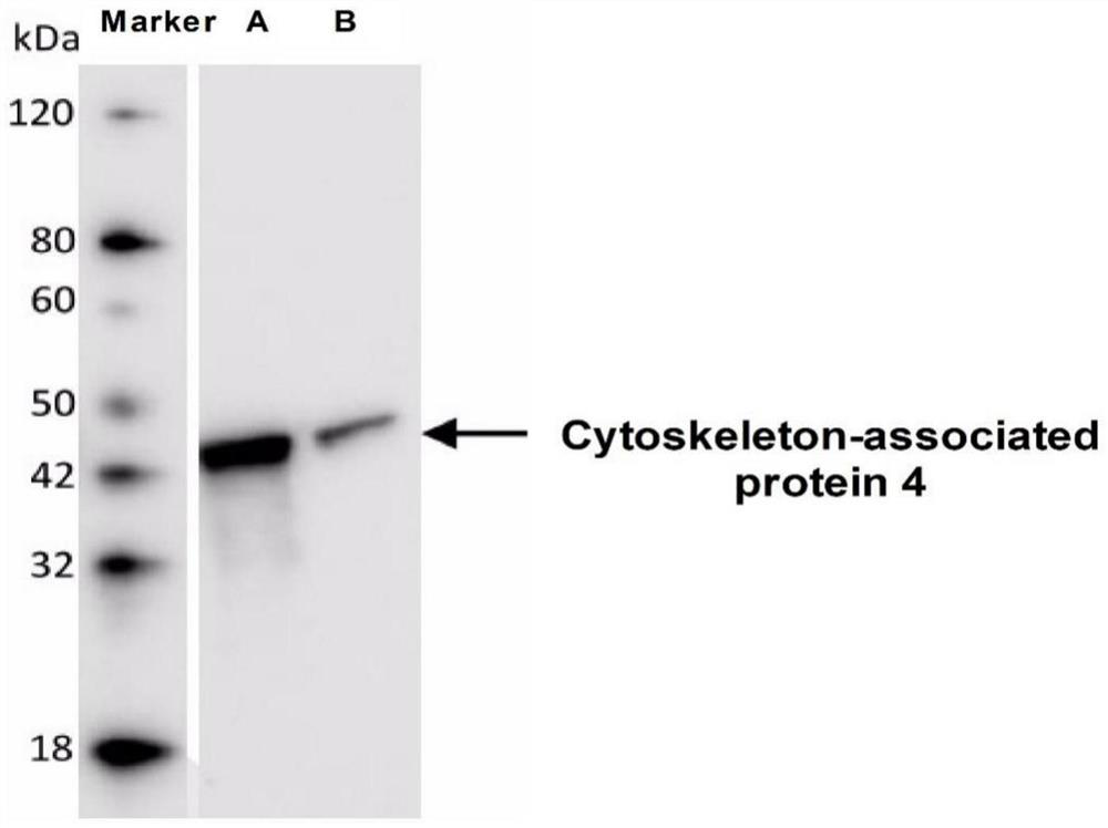 Application of reagent for detecting anti-cytoskeleton associated protein 4-IgG autoantibody in preparation of kit for detecting vascular endothelial injury