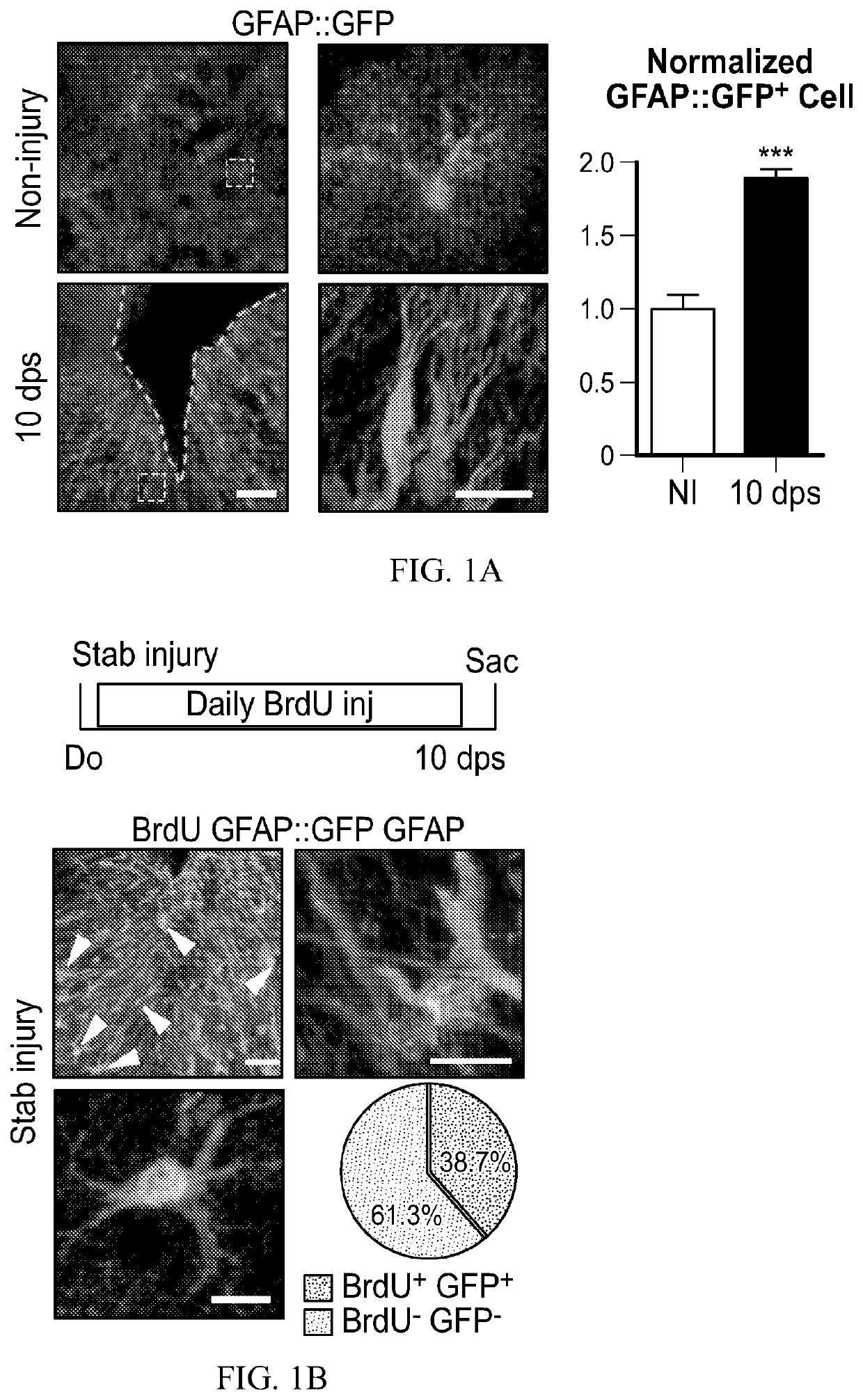 Methods and materials for treating brain injuries