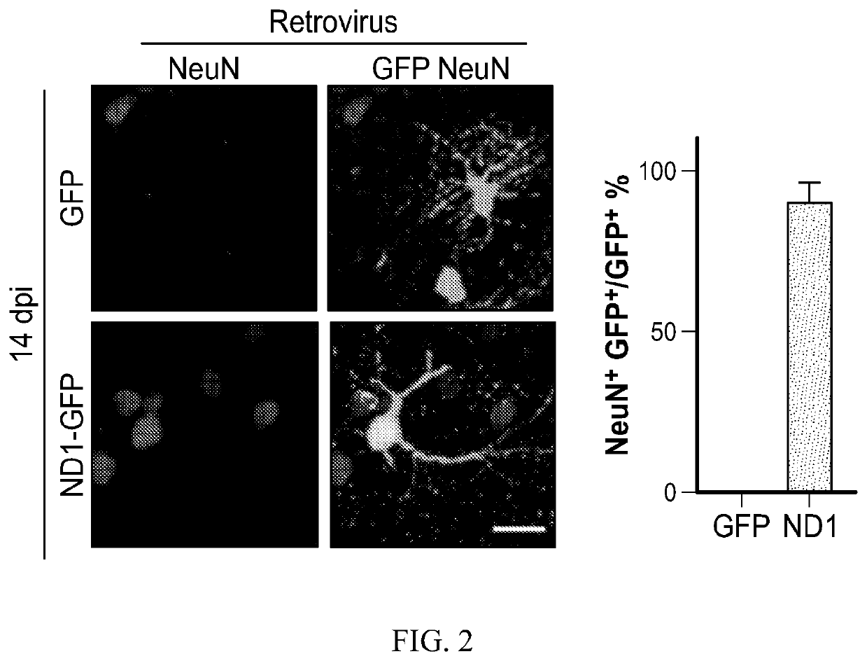 Methods and materials for treating brain injuries