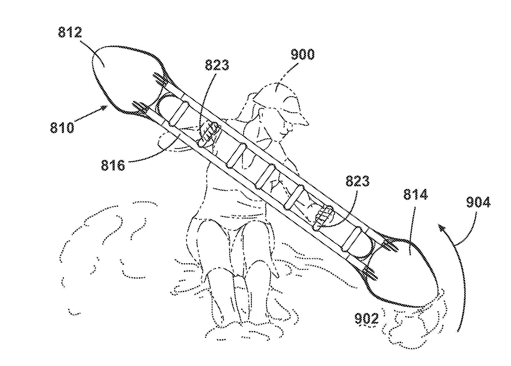 Exercise device and methods of use