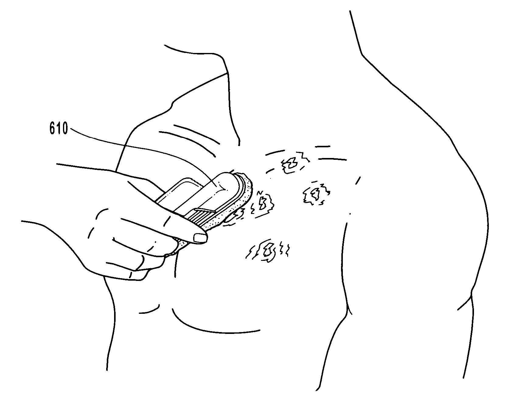 Anti-infective compositions, methods and systems for treating pathogen-induced disordered tissues