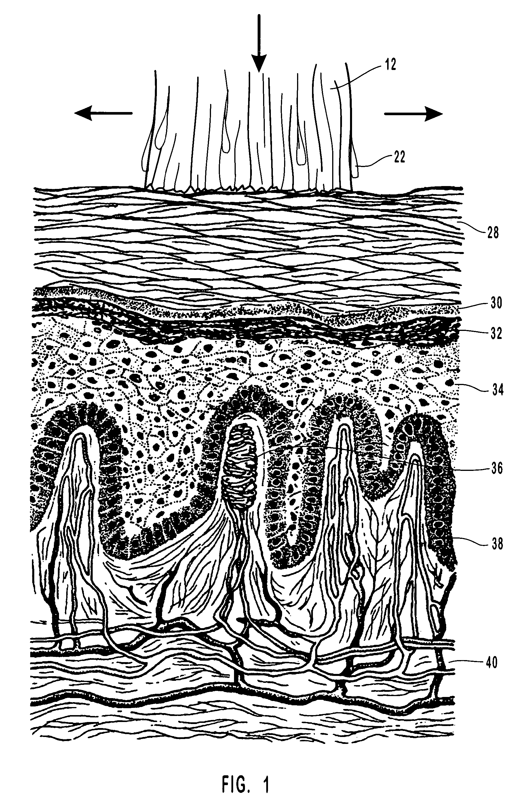 Anti-infective compositions, methods and systems for treating pathogen-induced disordered tissues