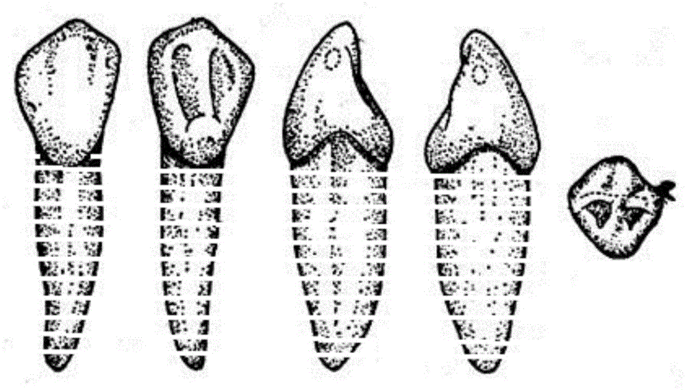 Tooth correctional system suitable for mixed dentition and manufacturing method