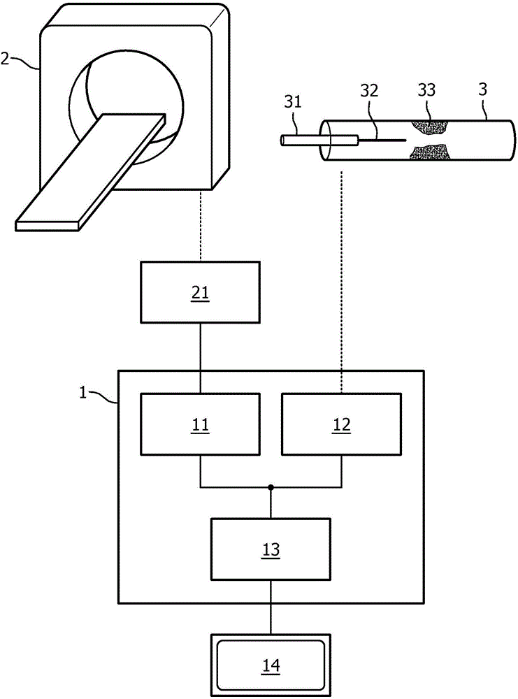 Processing apparatus and method for processing cardiac data of a living being