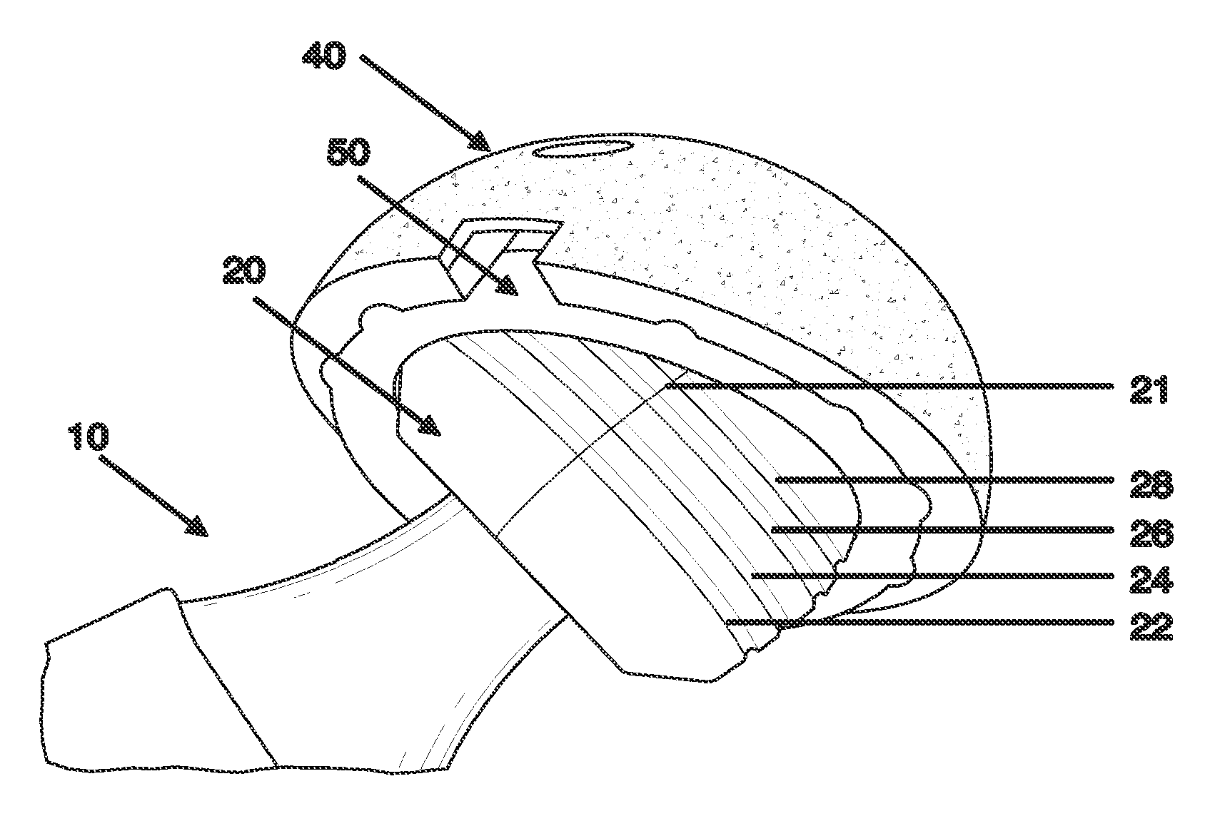 System of orienting femoral head for acetabular prosthesis alignment