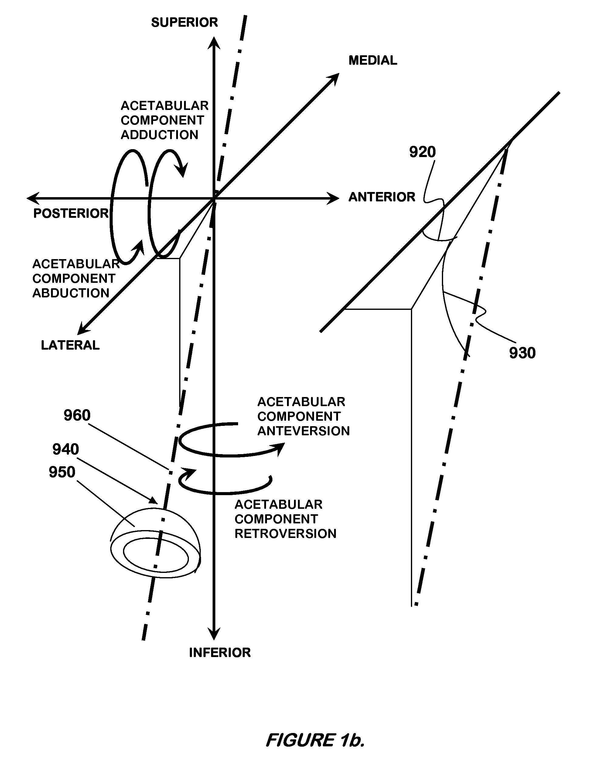 System of orienting femoral head for acetabular prosthesis alignment