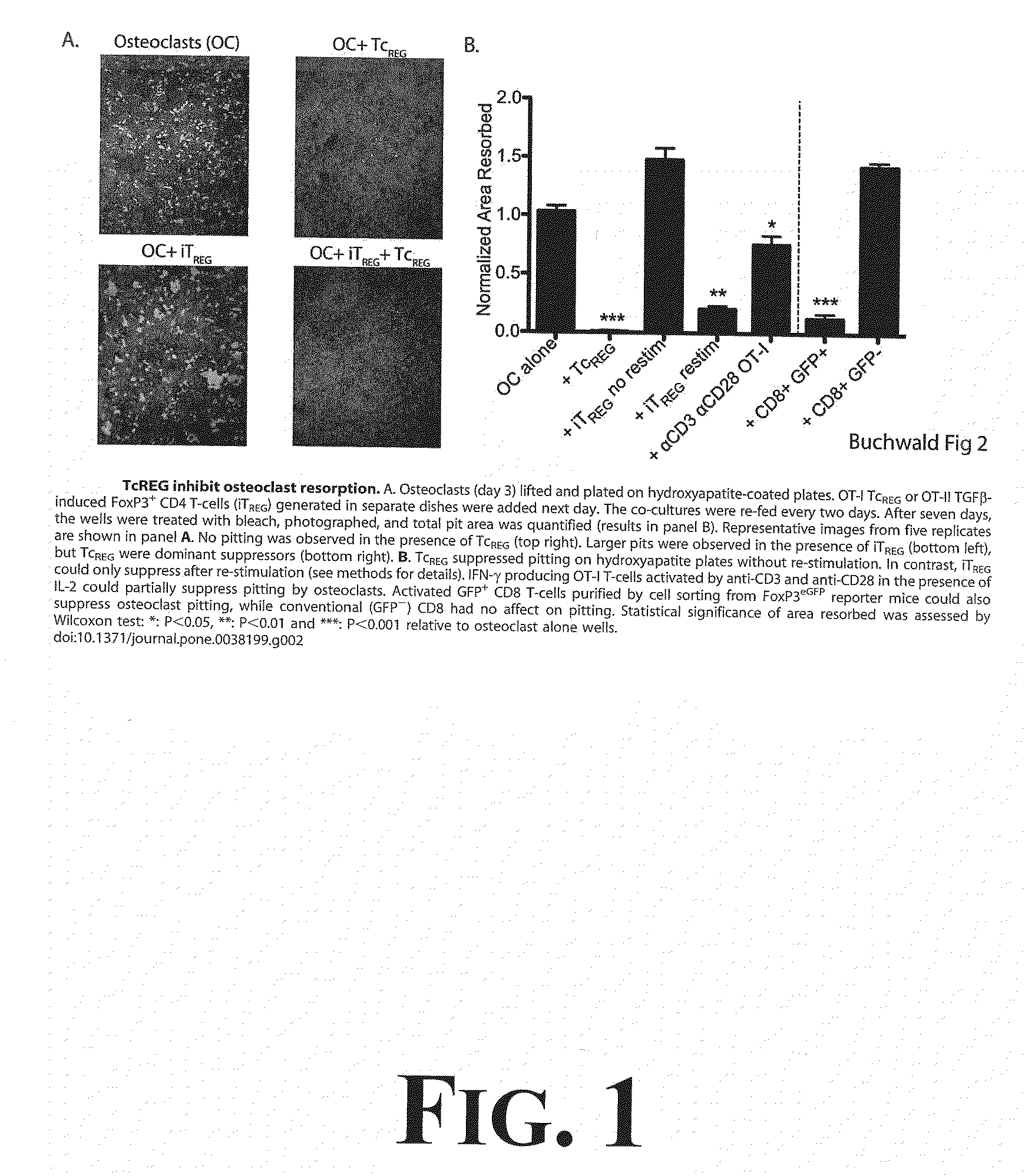 Suppression of bone loss by introducing FoxP3+ CD8 T-cells (Tc<sub>REG</sub>)