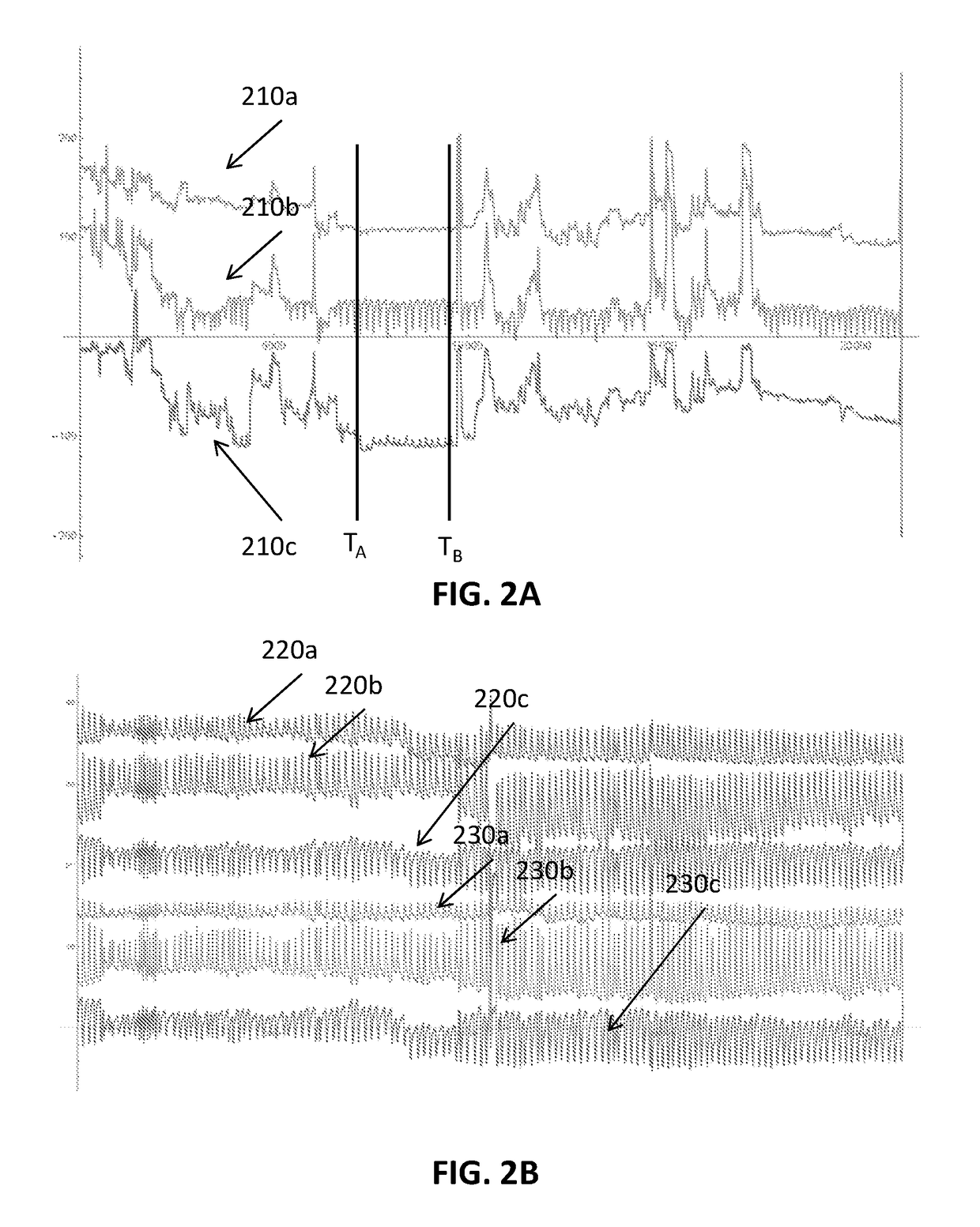 Respiration motion stabilization for lung magnetic navigation system