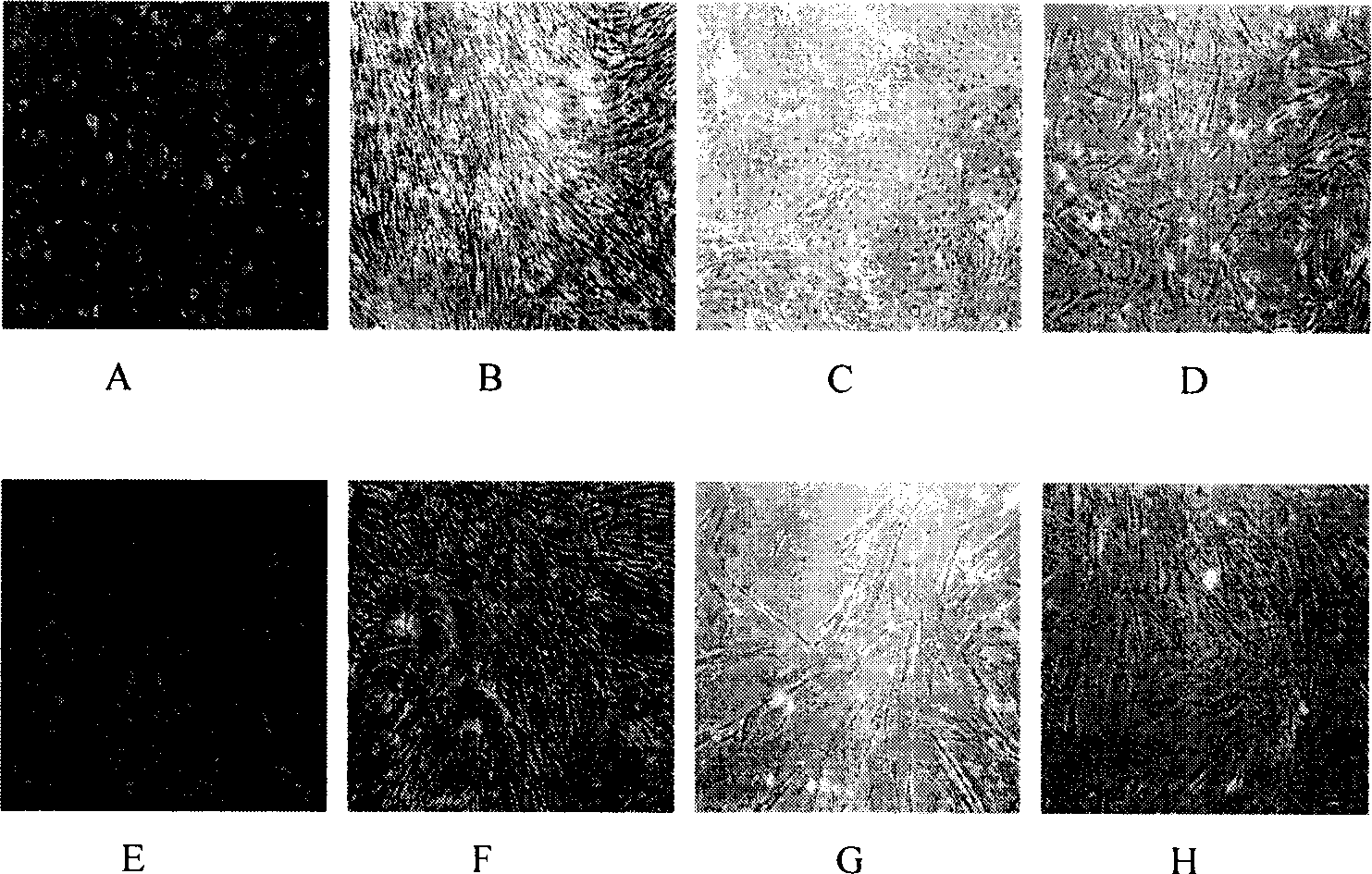 Separating and culturing process of human amnion mesenchyme stem cell and its medical composition