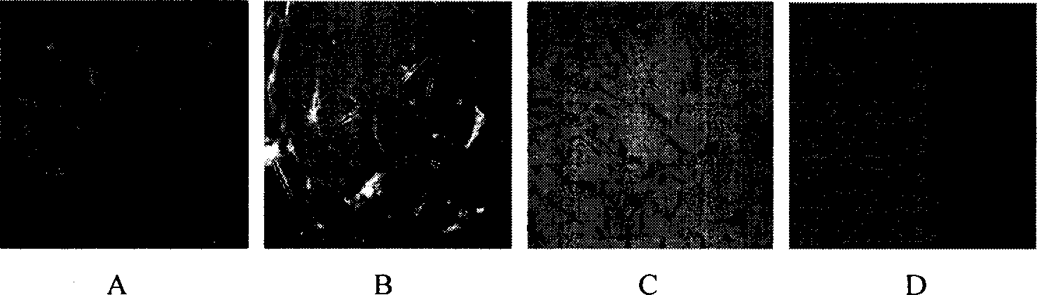 Separating and culturing process of human amnion mesenchyme stem cell and its medical composition