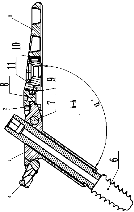 Angle-adjustable dynamic hip locking bone setting plate