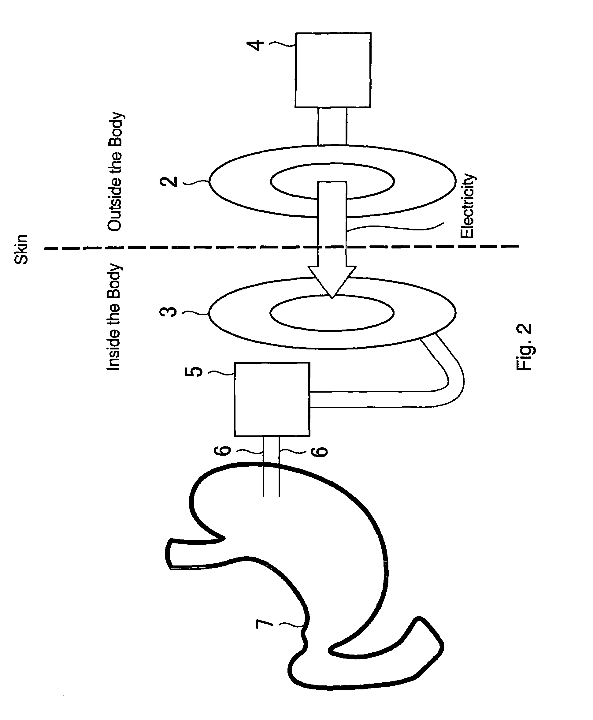 Device for electrically stimulating stomach