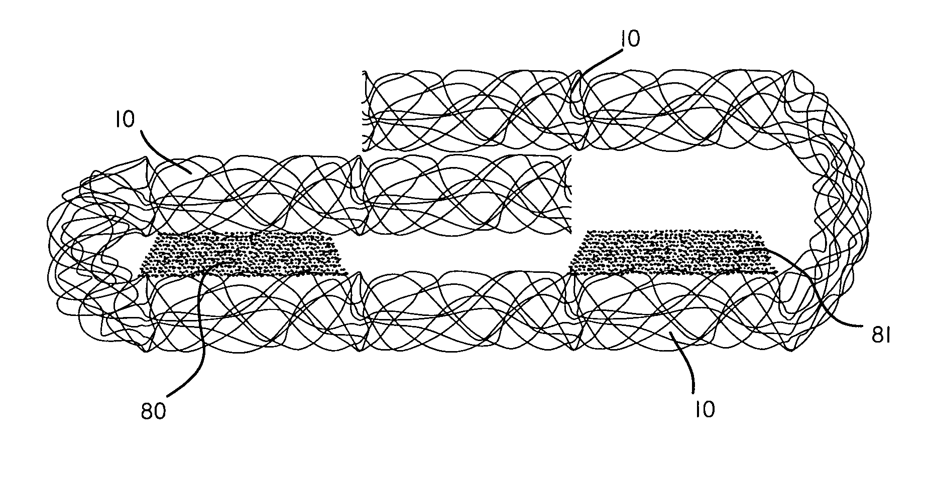 Planar-formed absorbent core structures