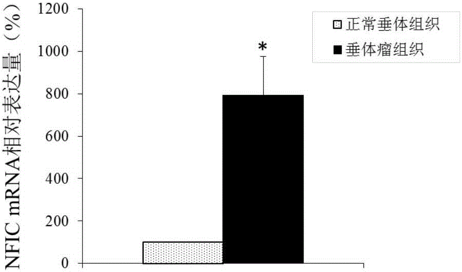 Application of NFIC gene in preparation of diagnostic and therapeutic products for pituitary adenomas