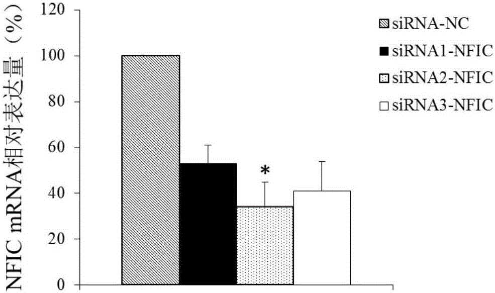 Application of NFIC gene in preparation of diagnostic and therapeutic products for pituitary adenomas