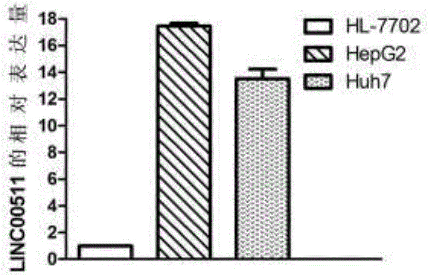 Biological marker for diagnosing and treating liver cancer