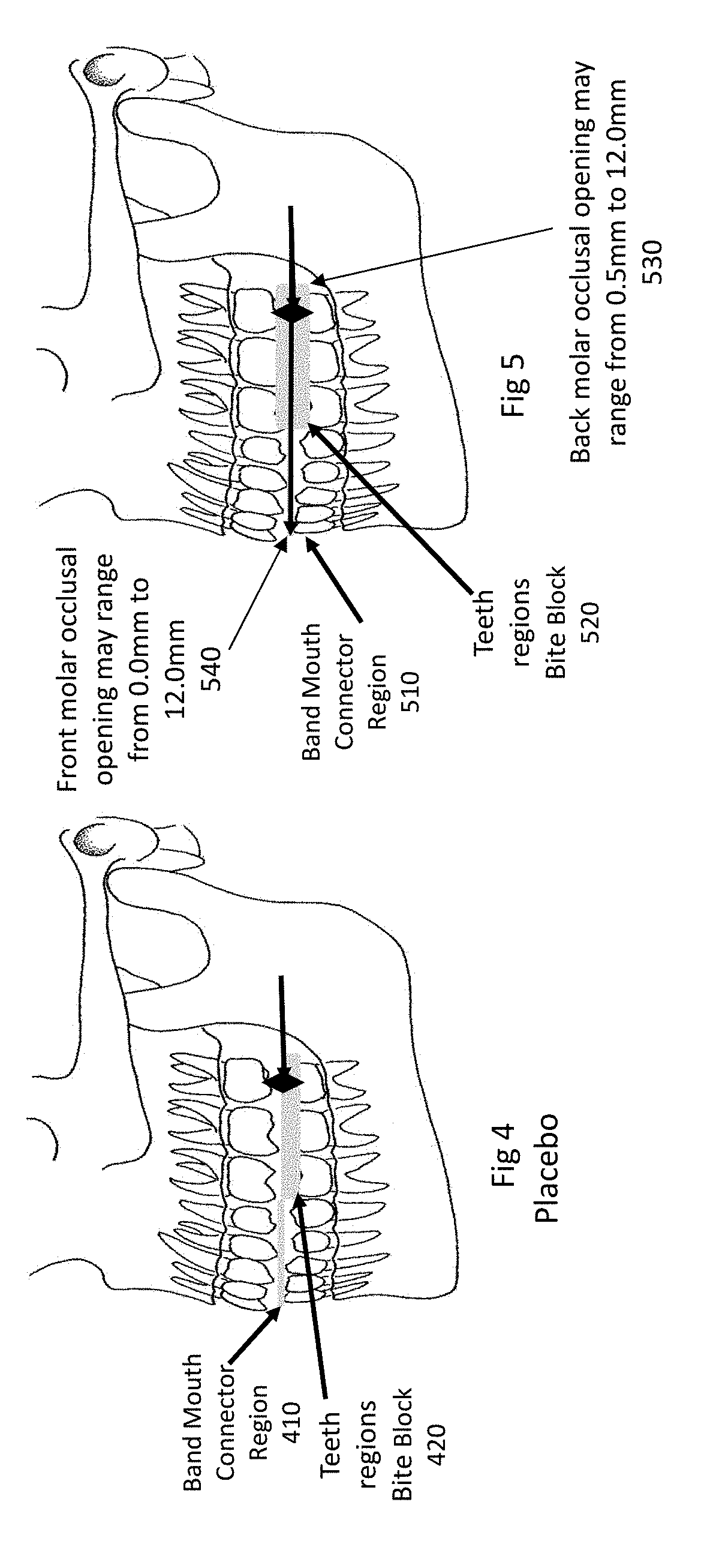 Airway and oxygen enhancement mouthpiece