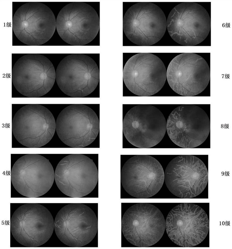 Eye fundus image analysis method and system and electronic equipment