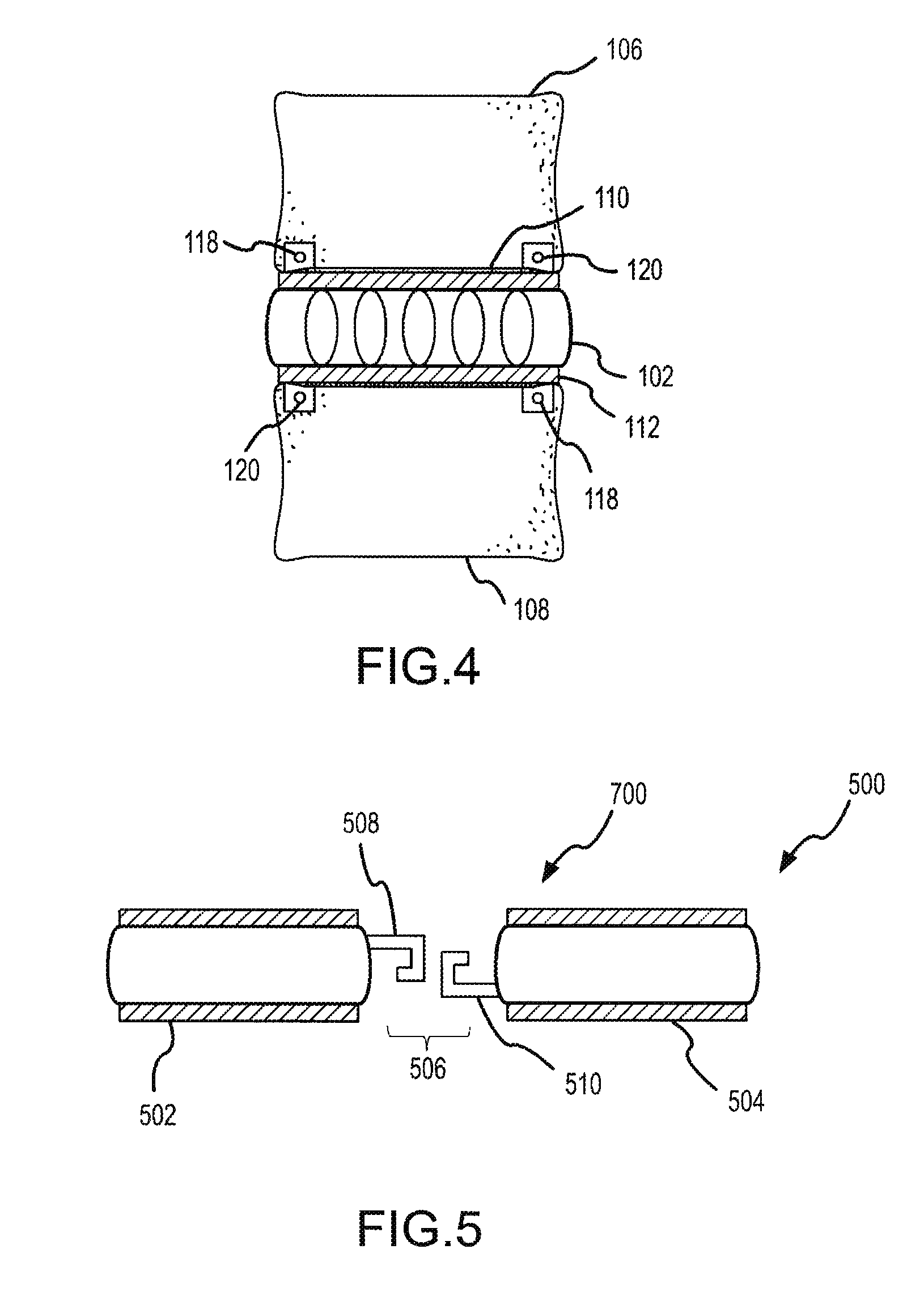 Corrective artificial disc