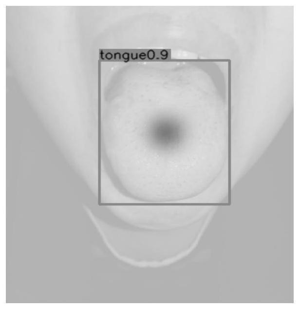 A Multi-label Classification Method for Tongue Image Based on Graph Convolutional Network