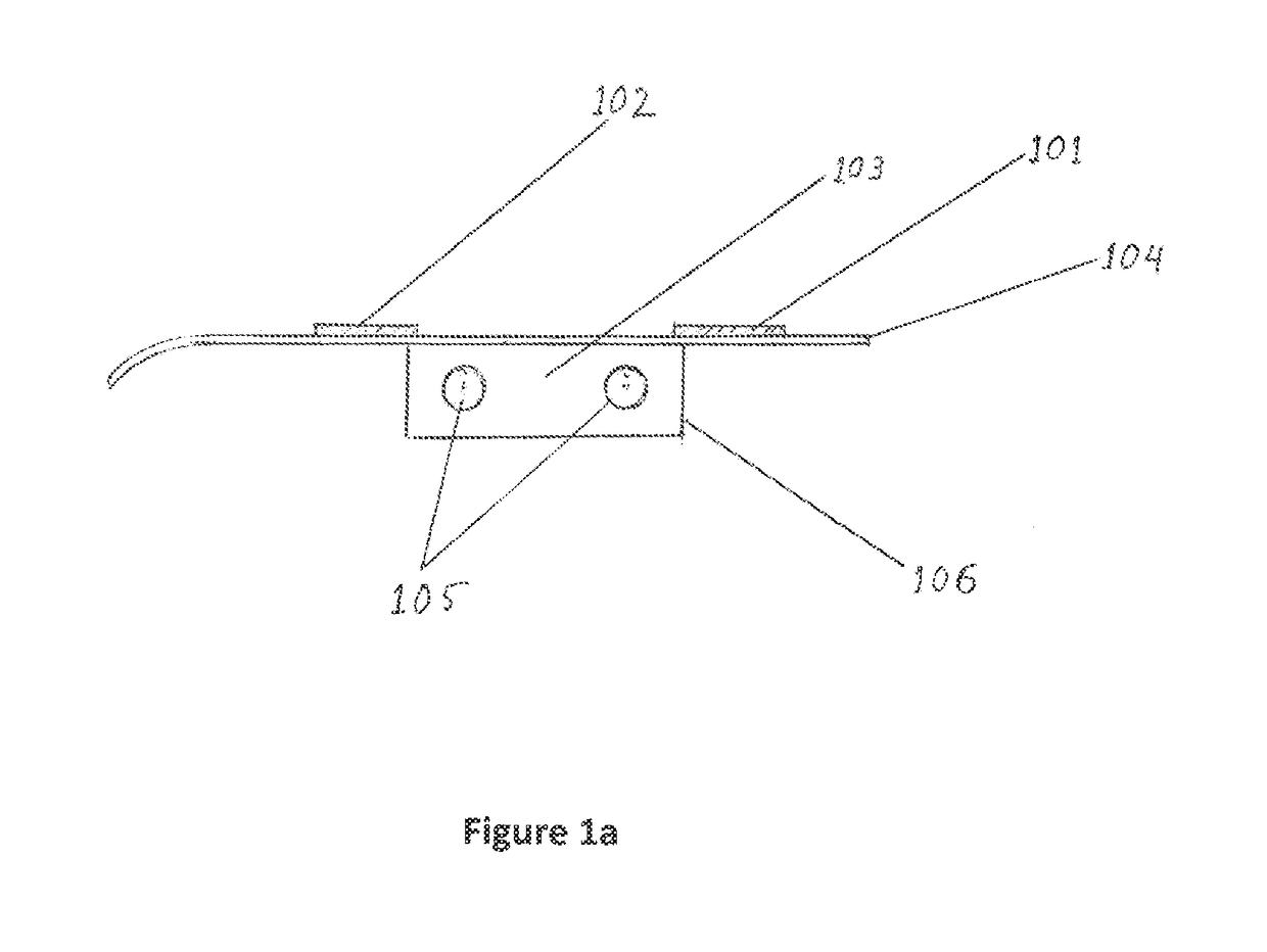 Non-invasive device and method for treating gastro esophageal reflux disease (GERD) and the digestive system