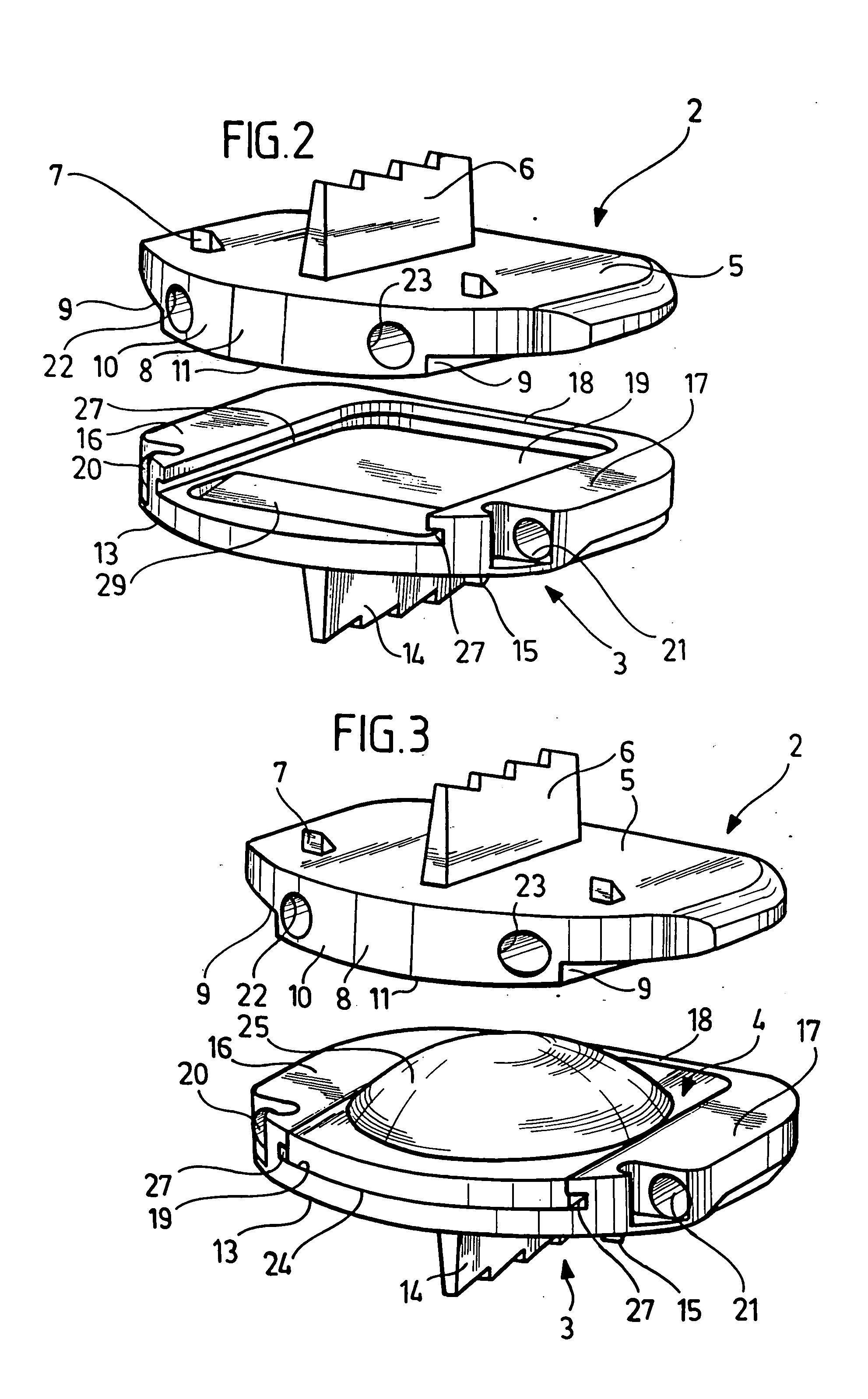 Intervertebral implant