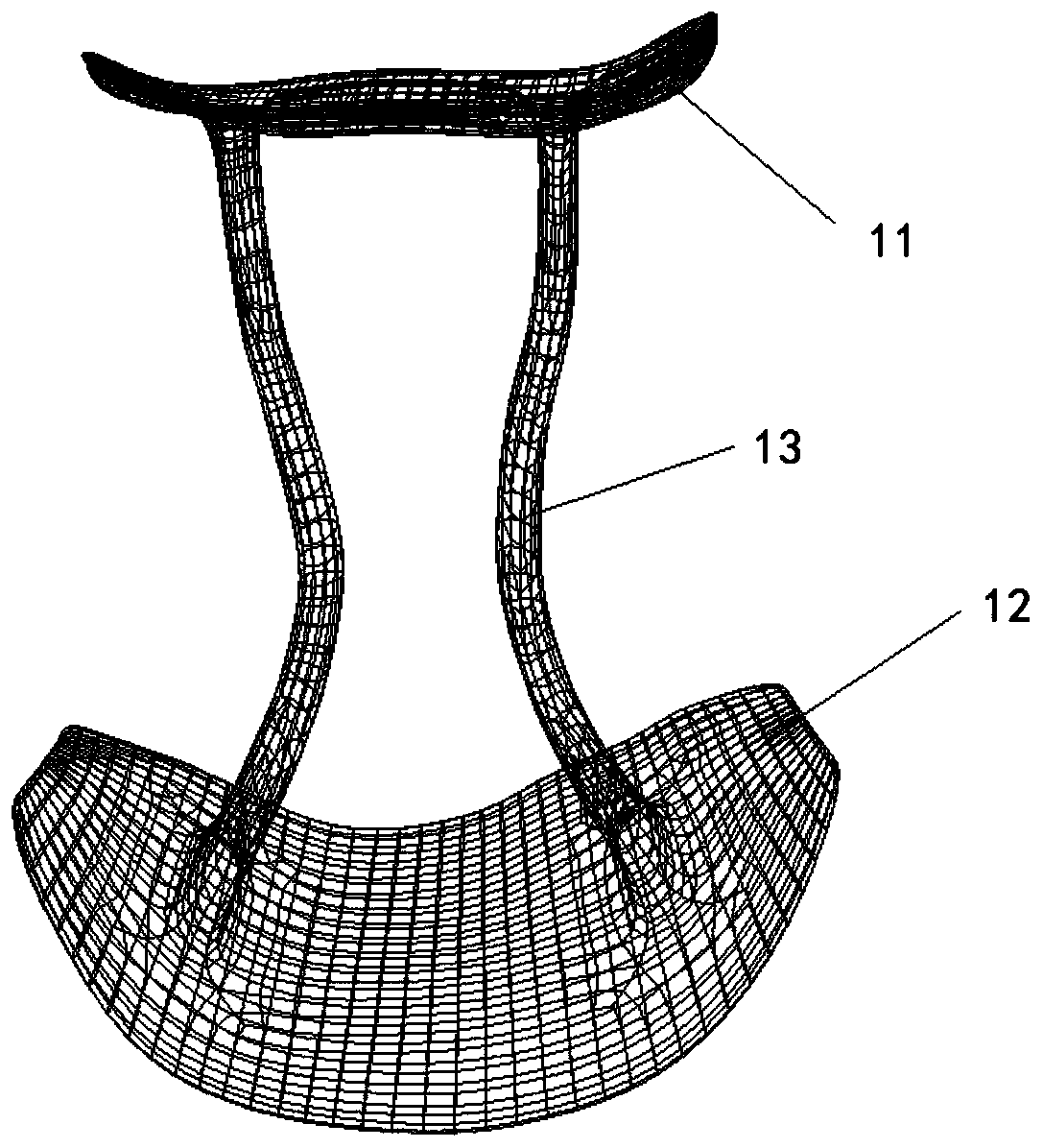 3D-printed cervical total spondylectomy implantable prosthetic device