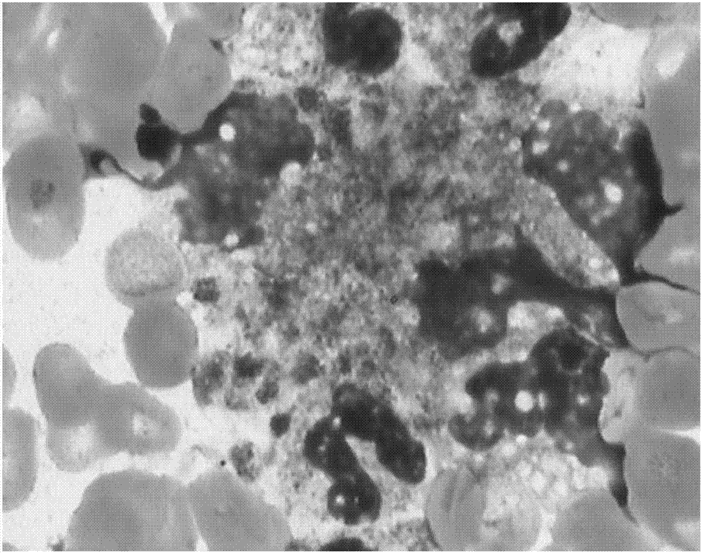 Method for pre-diluting vacuum blood collection tube and for measuring platelet number