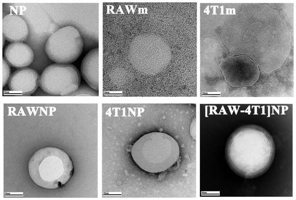 Multi-targeting fusion cell membrane modified bionic nano delivery system as well as preparation method and application thereof