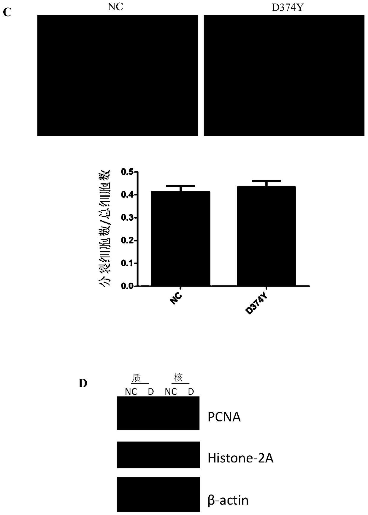 The application of the d374y mutant of pcsk9 protein in inhibiting the migration of liver cancer cells